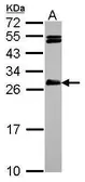 Anti-HAUS2 antibody [N1C3] used in Western Blot (WB). GTX118696