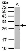 Anti-PRTFDC1 antibody [N1C3] used in Western Blot (WB). GTX118699
