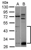 Anti-ZNF410 antibody [N1C1] used in Western Blot (WB). GTX118703
