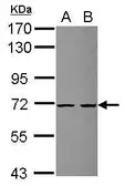 Anti-ZSWIM2 antibody [C1C3] used in Western Blot (WB). GTX118710