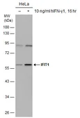 Anti-IFIT1 antibody [N1C1] used in Western Blot (WB). GTX118713