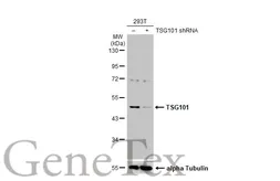 Anti-TSG101 antibody used in Western Blot (WB). GTX118736