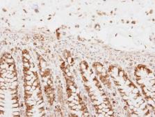 Anti-PNPase antibody used in IHC (Paraffin sections) (IHC-P). GTX118737