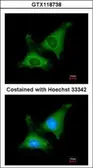 Anti-mtPAP antibody [N1C3] used in Immunocytochemistry/ Immunofluorescence (ICC/IF). GTX118738