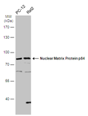 Anti-Nuclear Matrix Protein p84 antibody used in Western Blot (WB). GTX118740