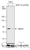 Anti-Mre11 antibody used in Western Blot (WB). GTX118741