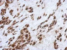 Anti-CCDC44 antibody used in IHC (Paraffin sections) (IHC-P). GTX118757