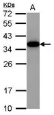 Anti-Akirin 2 antibody [N1C3] used in Western Blot (WB). GTX118763