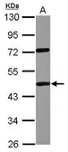 Anti-DDX19A antibody [C1C3] used in Western Blot (WB). GTX118765