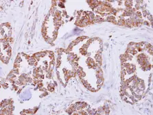 Anti-MRPL11 antibody [N1C3] used in IHC (Paraffin sections) (IHC-P). GTX118773