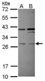 Anti-PLEKHF2 antibody used in Western Blot (WB). GTX118774