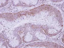 Anti-GFOD2 antibody [C1C3] used in IHC (Paraffin sections) (IHC-P). GTX118777