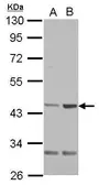 Anti-QTRT1 antibody used in Western Blot (WB). GTX118778