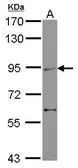 Anti-ZMIZ2 antibody [C1C3] used in Western Blot (WB). GTX118779