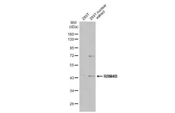 Anti-RBM4B antibody [N2C3] used in Western Blot (WB). GTX118781