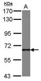 Anti-DDX49 antibody [N1C1] used in Western Blot (WB). GTX118802