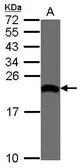 Anti-EIF1A antibody [N1C3] used in Western Blot (WB). GTX118810