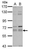 Anti-C3IP1 antibody [N1C1] used in Western Blot (WB). GTX118827