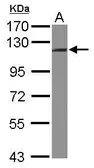 Anti-INTS5 antibody [C2C3], C-term used in Western Blot (WB). GTX118831