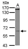 Anti-KIF19 antibody [N1N3] used in Western Blot (WB). GTX118841
