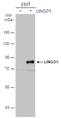 Anti-LINGO1 antibody [C1C3] used in Western Blot (WB). GTX118853