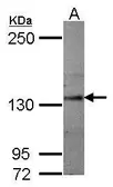 Anti-Semaphorin 5A antibody [C1C3] used in Western Blot (WB). GTX118856