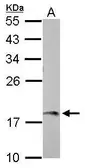 Anti-AMELX antibody used in Western Blot (WB). GTX118869