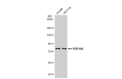 Anti-PDE10A antibody [C2C3], C-term used in Western Blot (WB). GTX118886