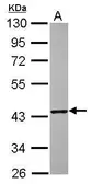 Anti-TXNL2 antibody [N1C2] used in Western Blot (WB). GTX118893