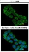 Anti-EIF3A antibody [N1N2], N-term used in Immunocytochemistry/ Immunofluorescence (ICC/IF). GTX118895