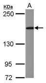 Anti-EIF3A antibody [N1N2], N-term used in Western Blot (WB). GTX118895