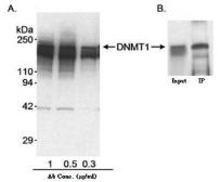 Anti-DNMT1 antibody used in Immunoprecipitation (IP). GTX11891