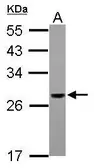 Anti-PSMG1 antibody [N1C3] used in Western Blot (WB). GTX118921