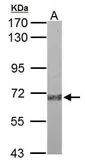 Anti-Plasma Kallikrein 1B antibody used in Western Blot (WB). GTX118926