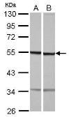 Anti-beta Tubulin antibody [N1C1] used in Western Blot (WB). GTX118928