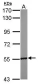 Anti-RCC2 antibody [N1C1] used in Western Blot (WB). GTX118930