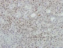 Anti-MINA53 antibody [N1N3] used in IHC (Paraffin sections) (IHC-P). GTX118937