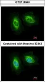 Anti-SASS6 antibody [N2C1], Internal used in Immunocytochemistry/ Immunofluorescence (ICC/IF). GTX118940
