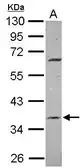 Anti-METTL2B antibody [N1C2] used in Western Blot (WB). GTX118942