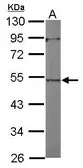 Anti-ACTL7A antibody [N1C2] used in Western Blot (WB). GTX118944