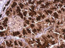 Anti-AIMP2 antibody [N1C1] used in IHC (Paraffin sections) (IHC-P). GTX118947