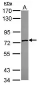 Anti-ZSWIM2 antibody [N1N3] used in Western Blot (WB). GTX118963
