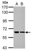 Anti-ZNF567 antibody [N2C2], Internal used in Western Blot (WB). GTX118964