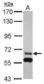 Anti-ZNF567 antibody [N1N3] used in Western Blot (WB). GTX118965