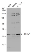 Anti-mtPAP antibody [N1C1] used in Western Blot (WB). GTX118983