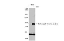 Anti-Influenza A virus PA protein antibody used in Western Blot (WB). GTX118991