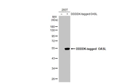 Anti-OASL antibody [N1C1] used in Western Blot (WB). GTX118999