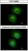 Anti-OASL antibody [N1C1] used in Immunocytochemistry/ Immunofluorescence (ICC/IF). GTX118999