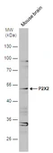 Anti-P2X2 antibody [N1C1] used in Western Blot (WB). GTX119003