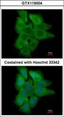 Anti-PHLPP2 antibody [N1N2], N-term used in Immunocytochemistry/ Immunofluorescence (ICC/IF). GTX119004